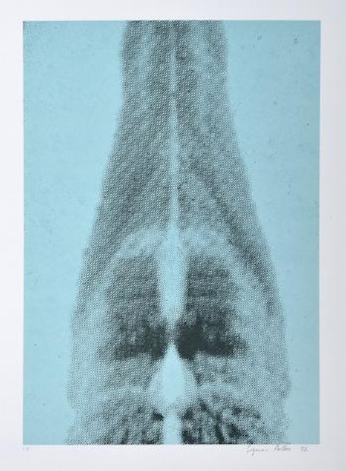 Ohne Titel (Röntgenbild) ,
1992 by Sigmar Polke