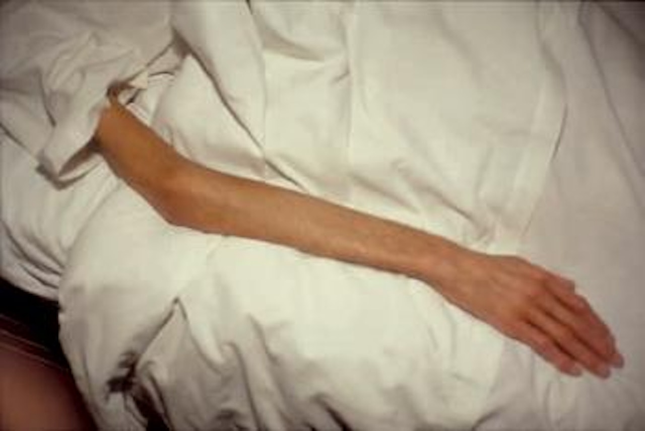 Gilles' arm, Paris ,
1993 by Nan Goldin