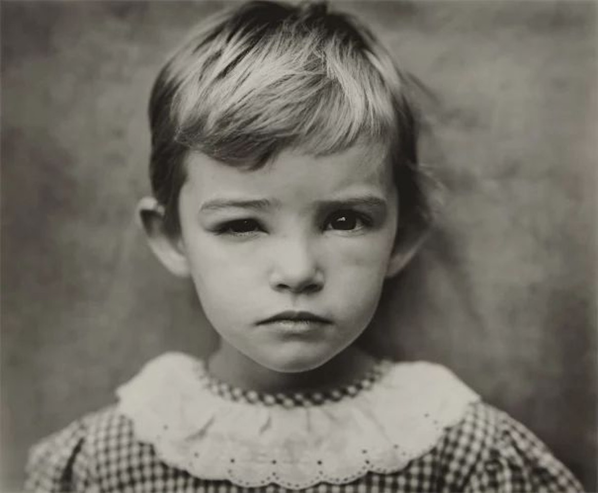 Damaged Child by Sally Mann