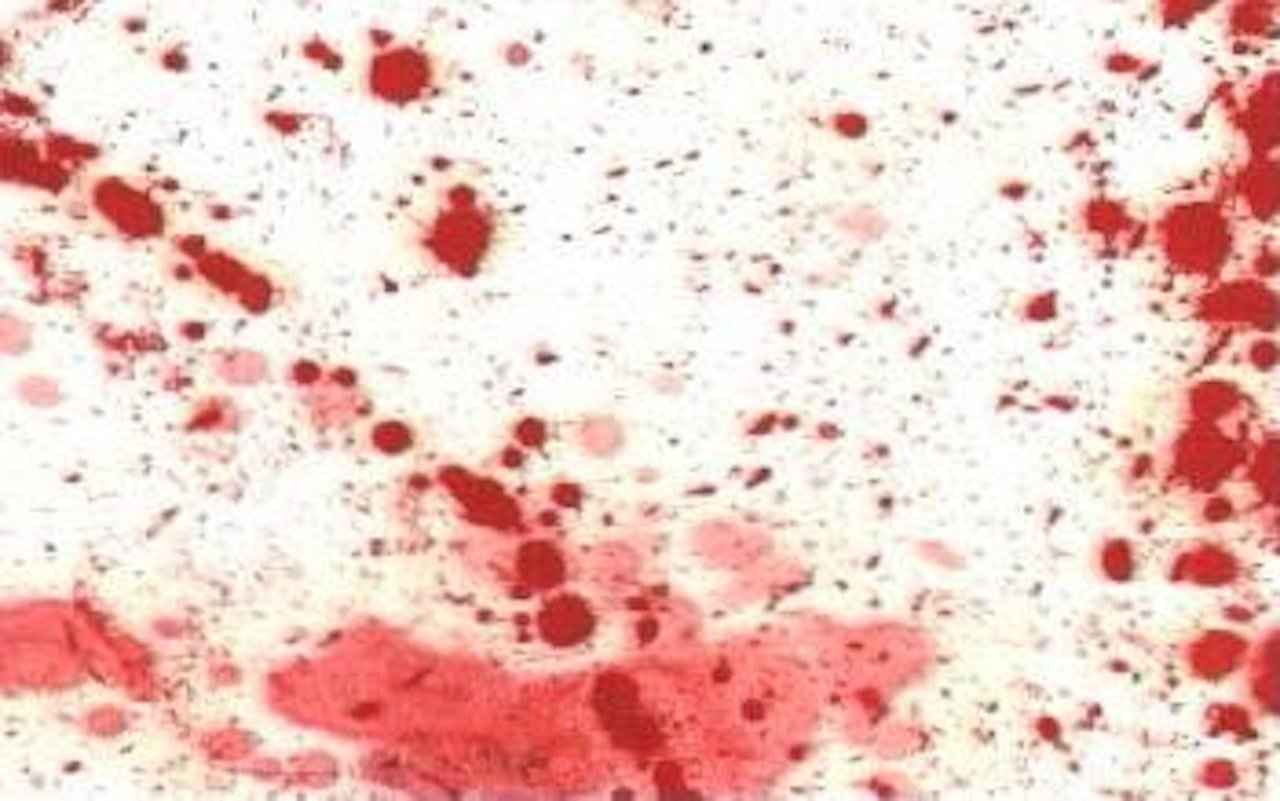 Untitled by Hermann Nitsch