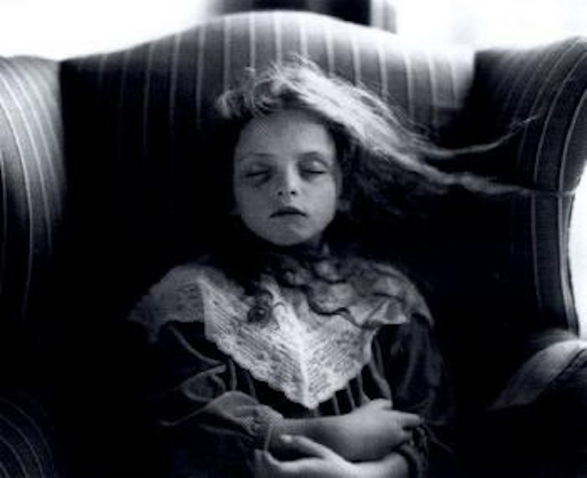 Black eye by Sally Mann