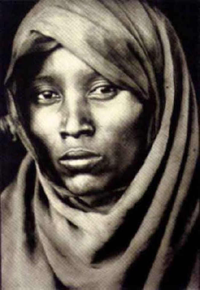 Boran patient at Marsabit Hospital by Peter Beard