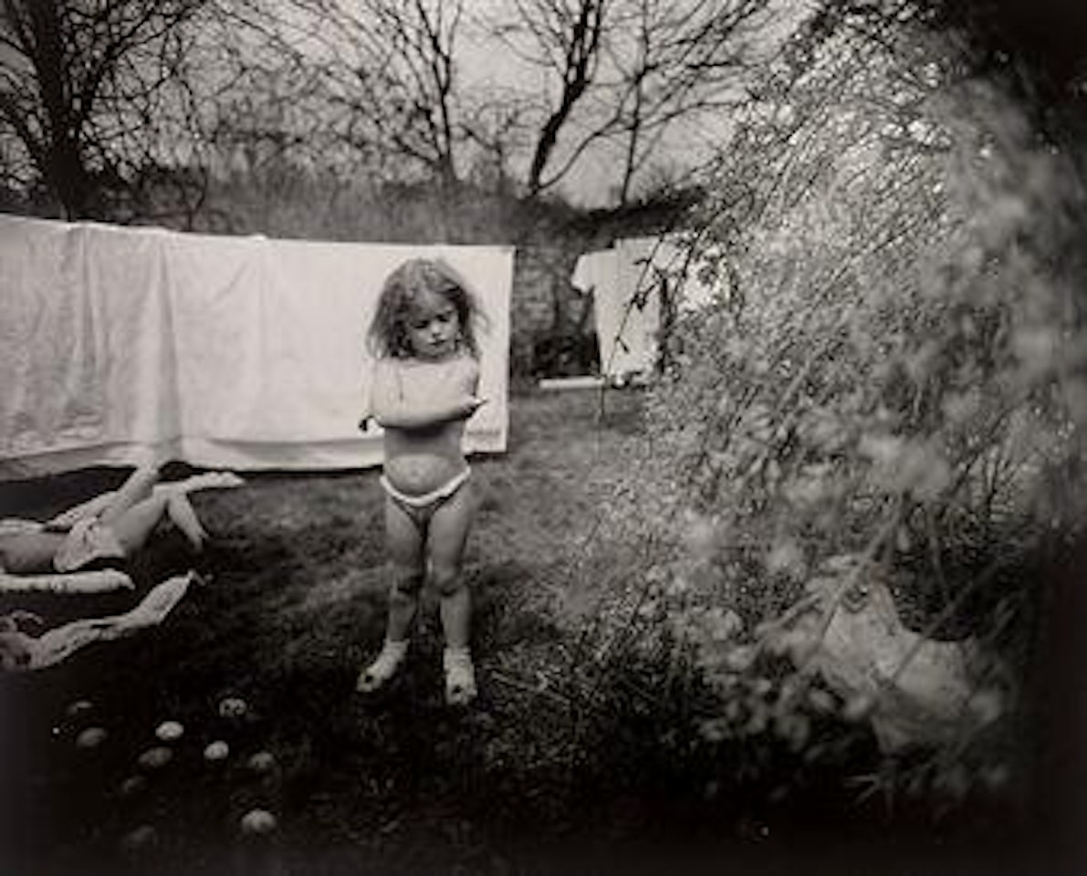 Hangnail by Sally Mann