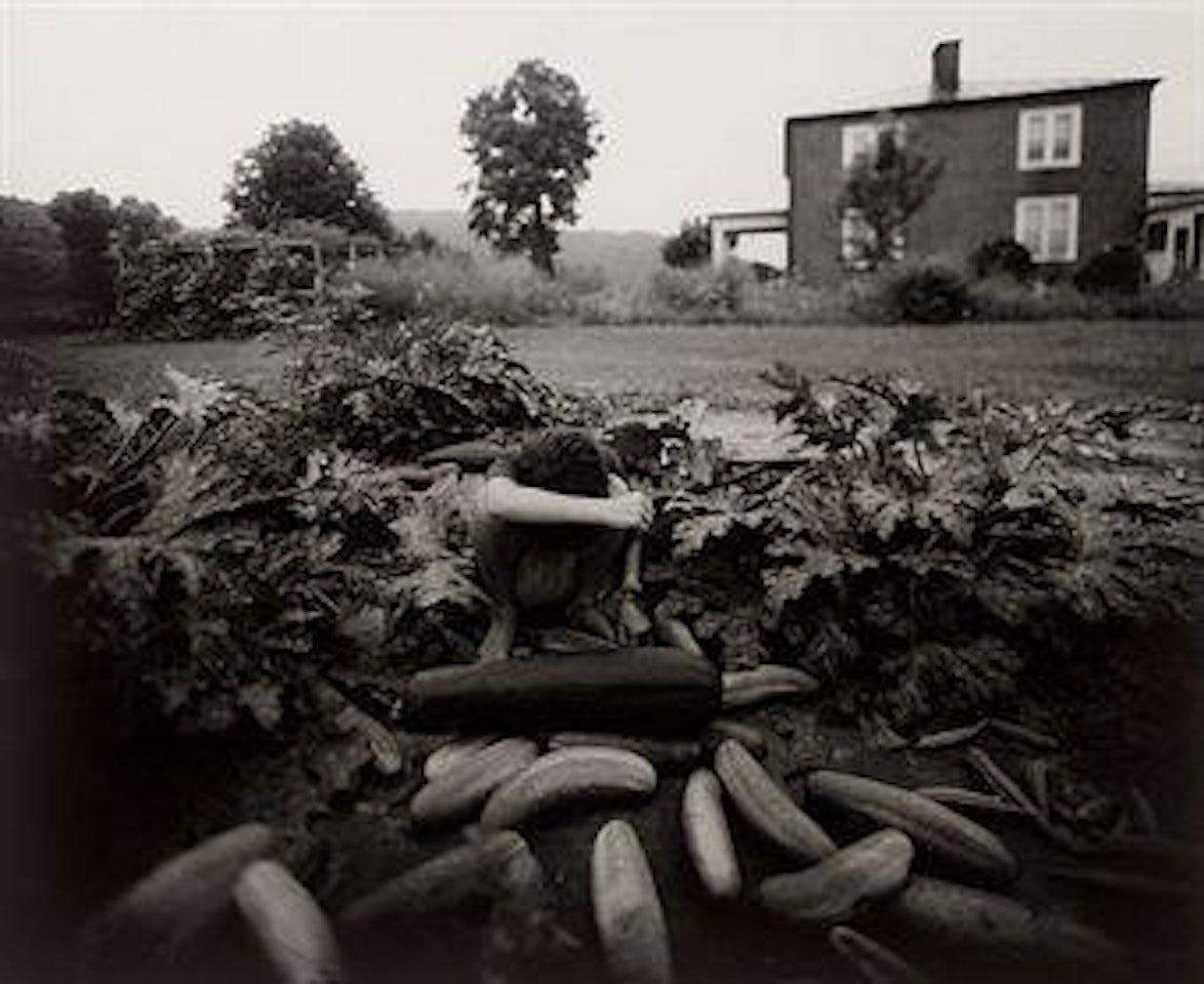 Emmett's Arm by Sally Mann