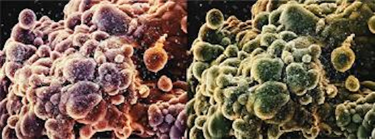 Second Series Biopsy: M865/303, M865/304 by Damien Hirst