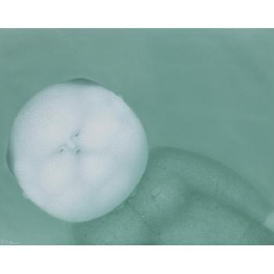 Pimple Series by Pan Dehai