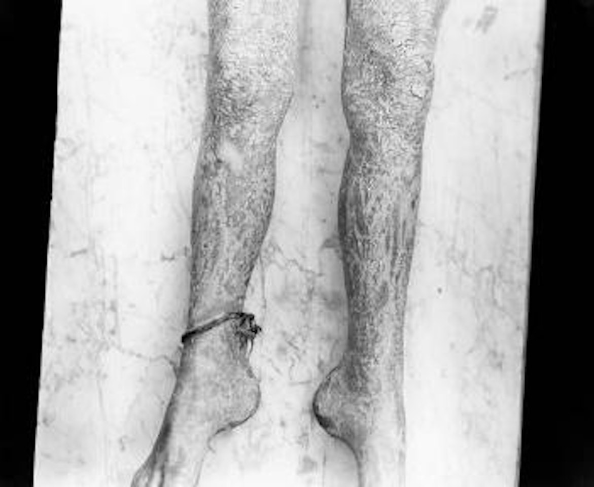 Flour paste by Sally Mann