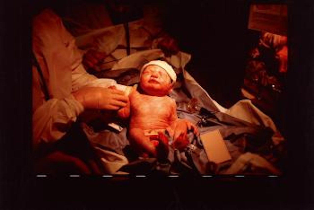 The Birth Of Lily June 2, 1990 Nyc by Nan Goldin