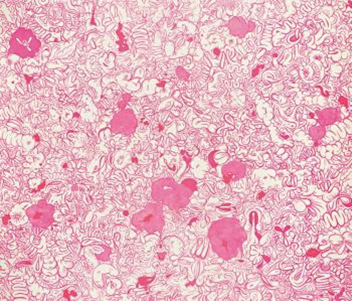 Sticky Beak, 2006 by Sue Williams