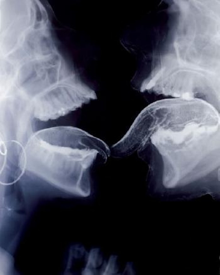 Lick 3 by Wim Delvoye