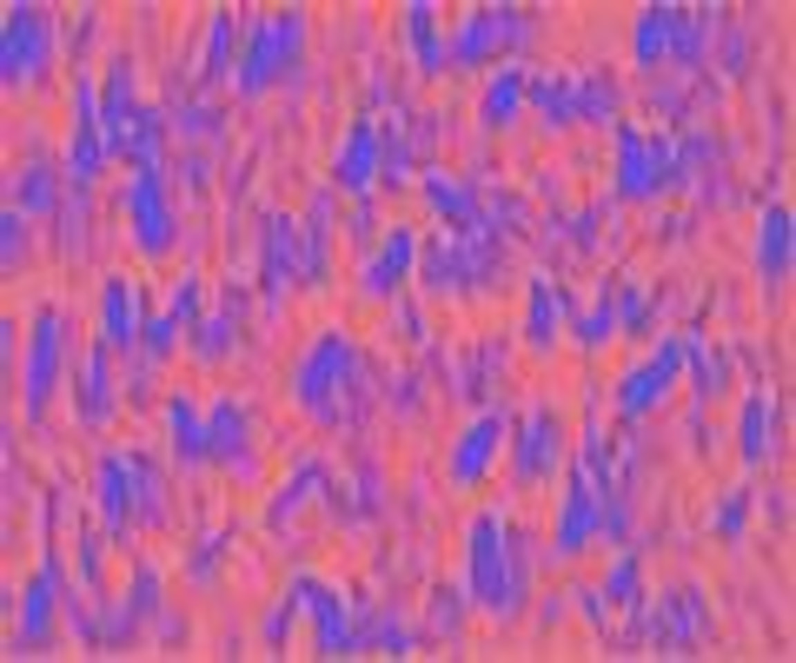 From winds by Lee Ufan