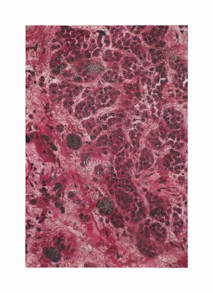 M220/140 Skin Mole, LM_SPL.jpg by Damien Hirst