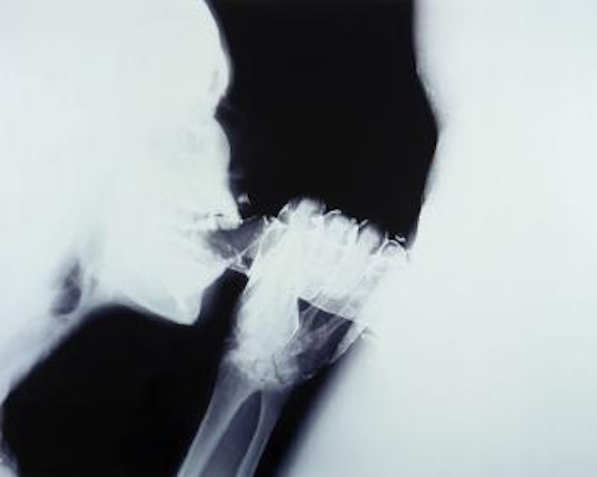 Pipe 2 by Wim Delvoye