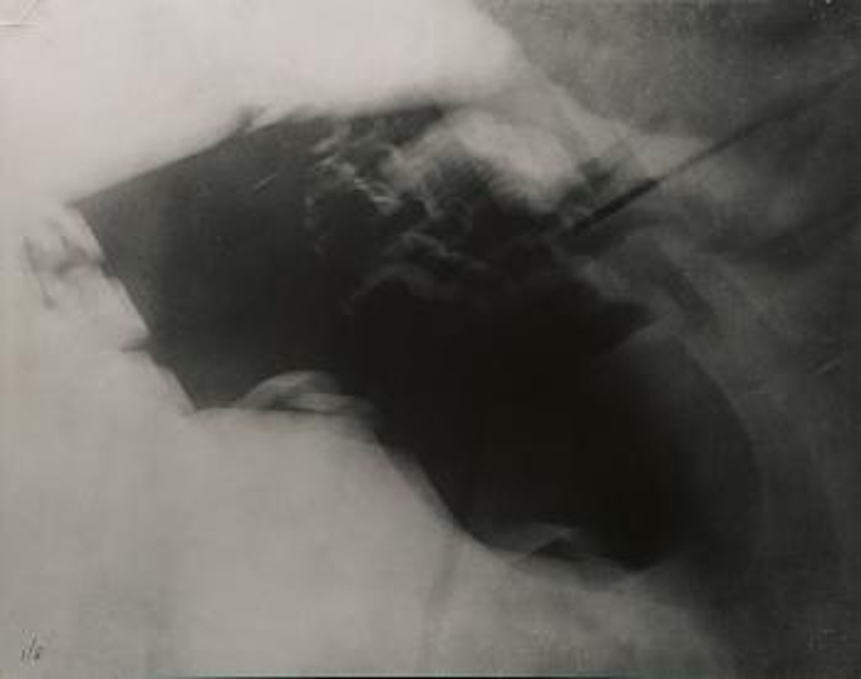 Inquietudine by Man Ray