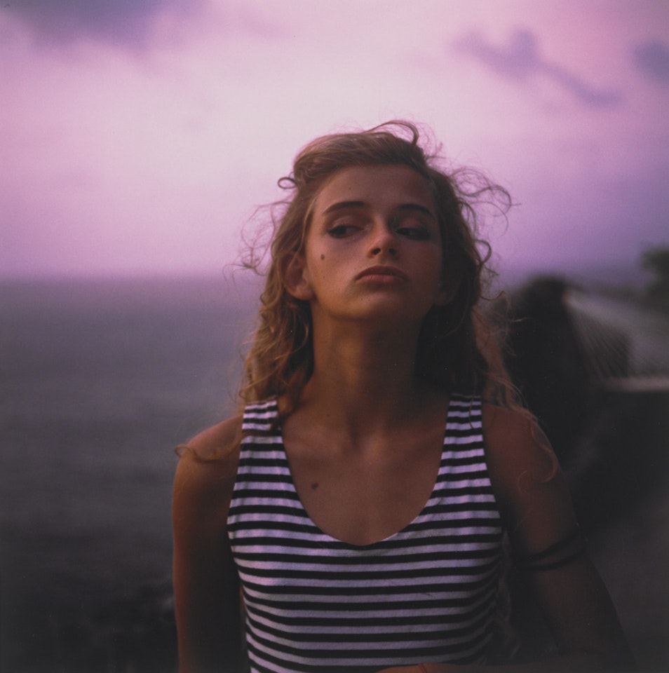 ARM BAND by Sally Mann
