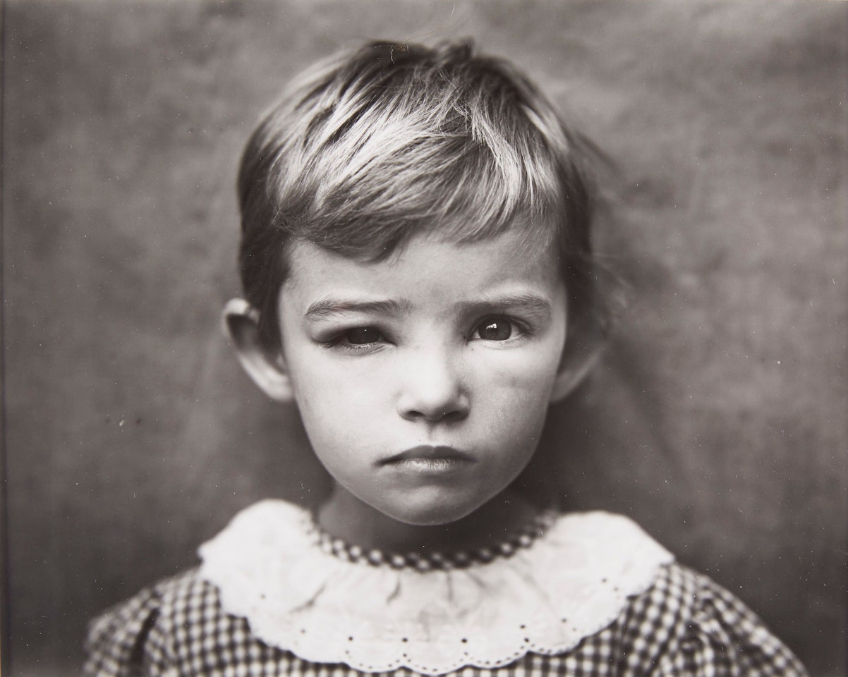 Damaged Child by Sally Mann