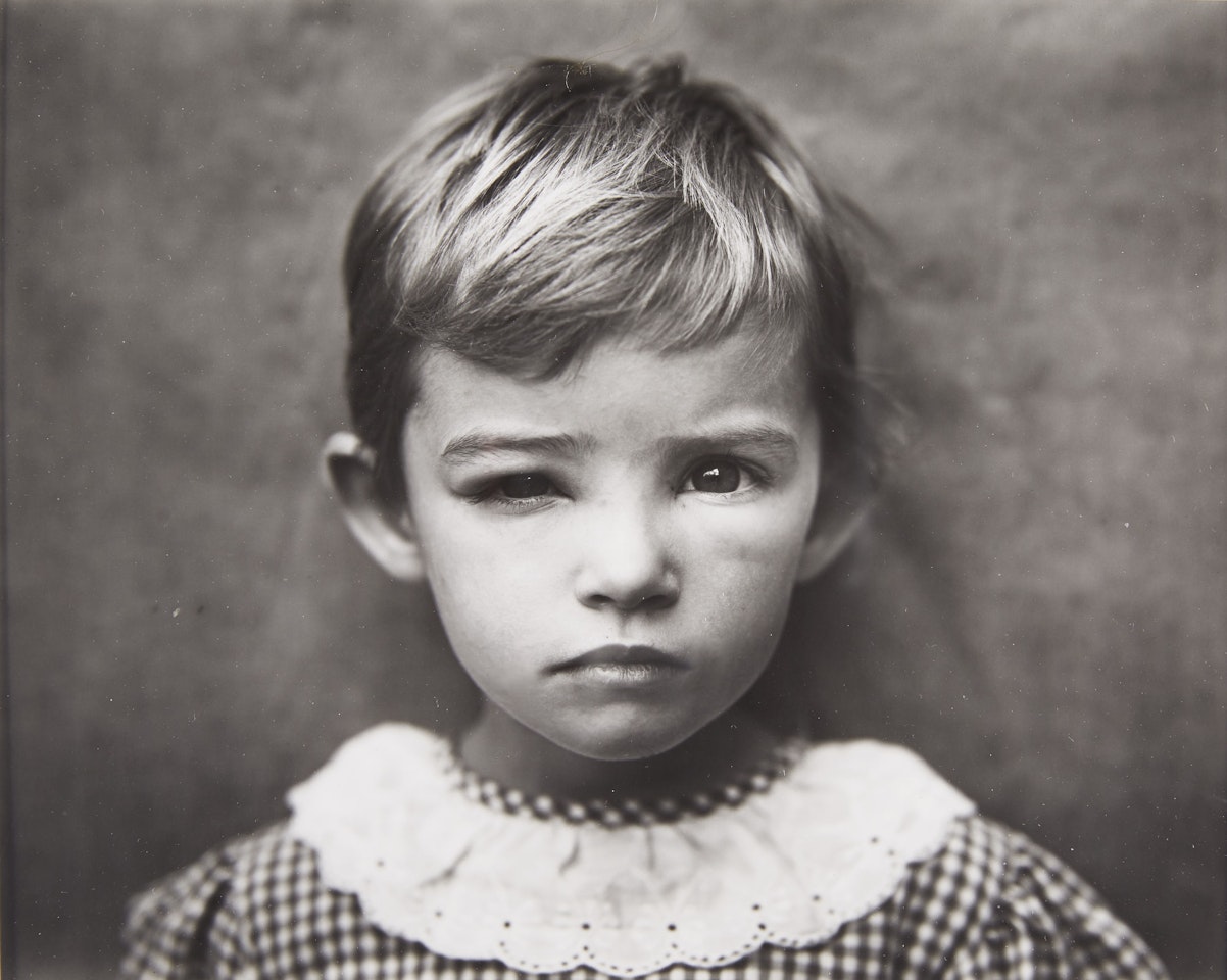 Damaged Child, 1984 by Sally Mann