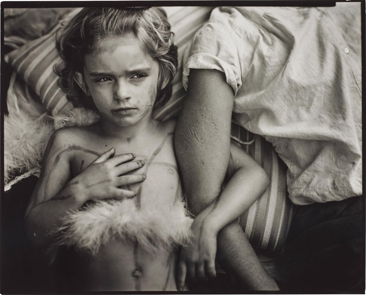 Jessie Bites by Sally Mann