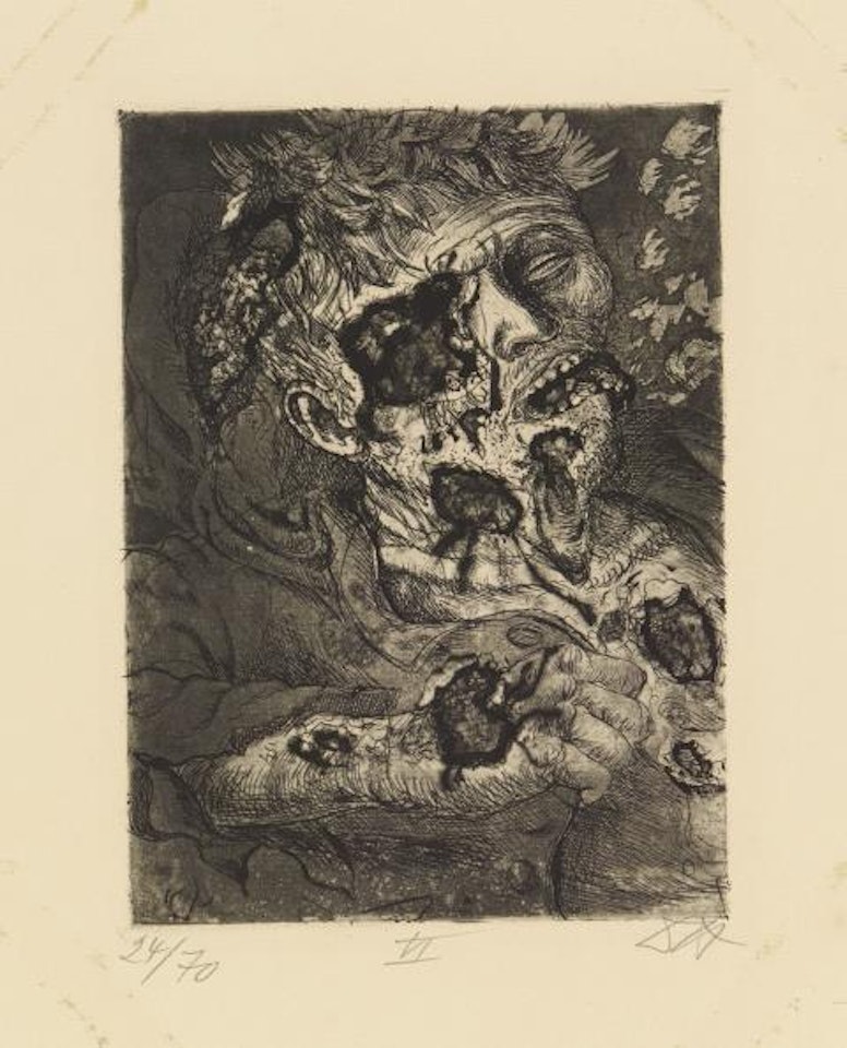 Verschüttete. Gastote. Sterbender Soldat by Otto Dix