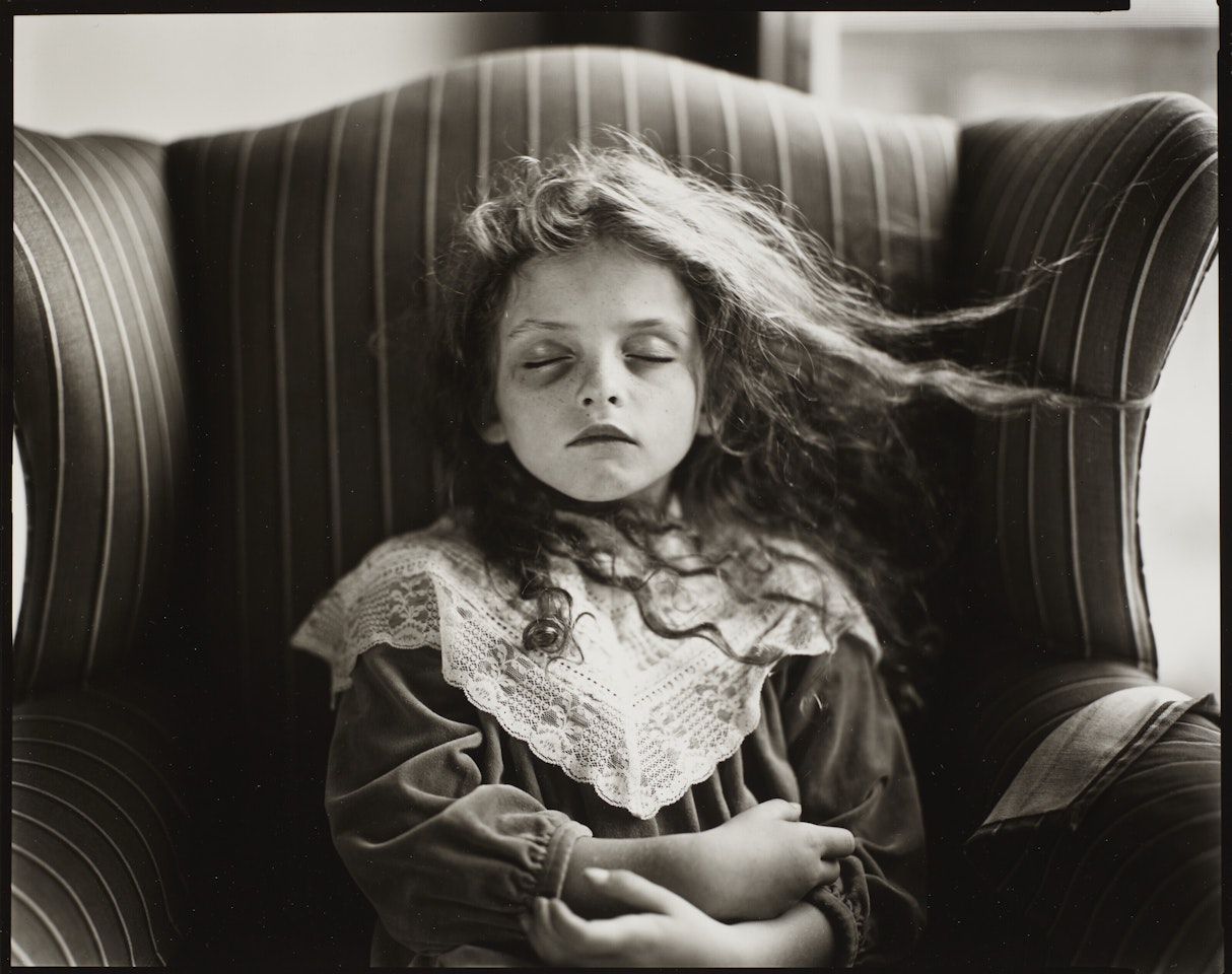 Black Eye by Sally Mann