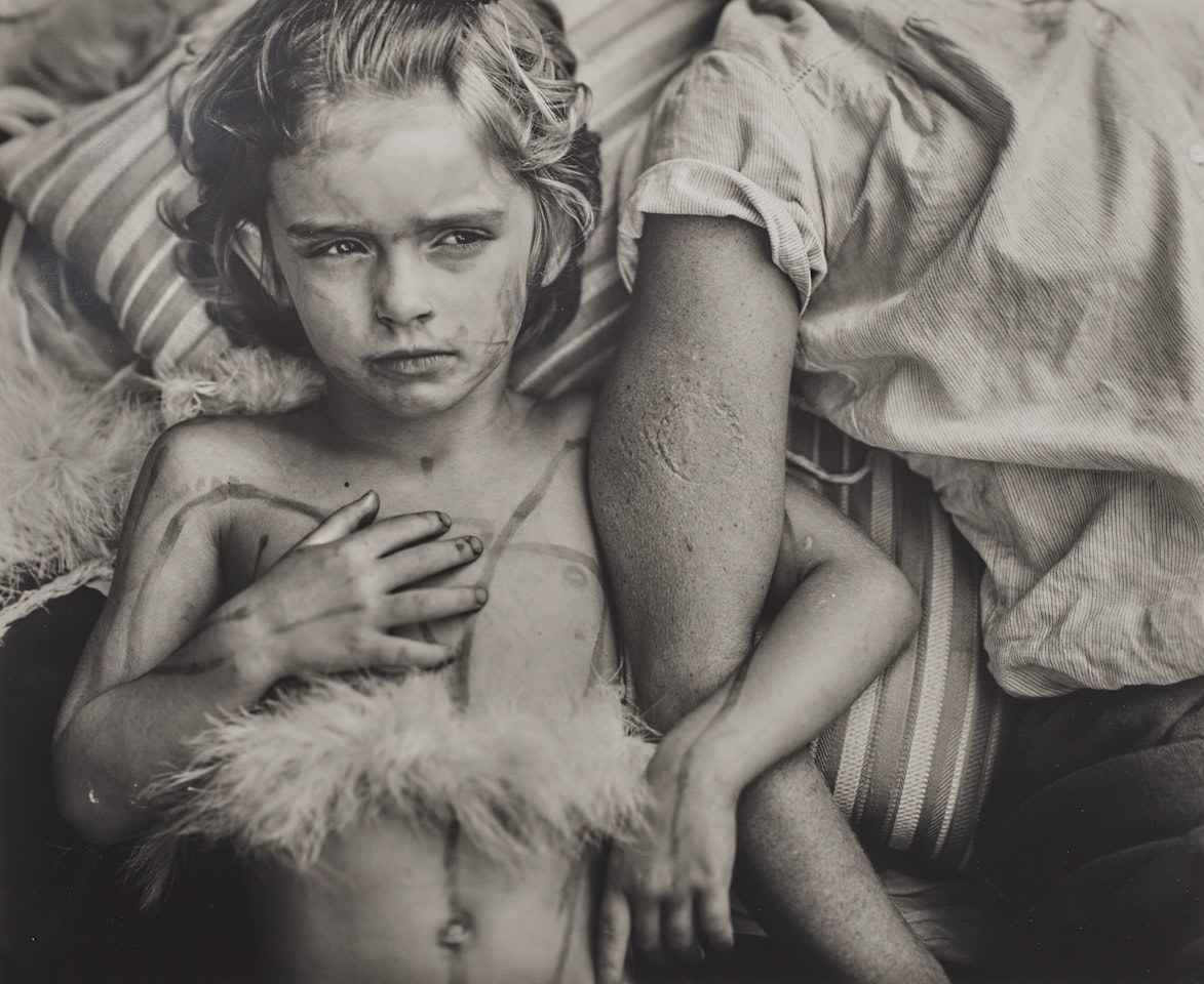 Jessie Bites by Sally Mann