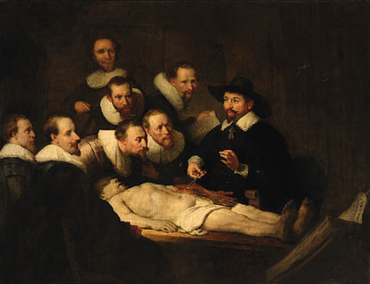 Anatomy lesson by doctor Nicolaes Tulp by Attributed to Rembrandt Harmensz van Rijn