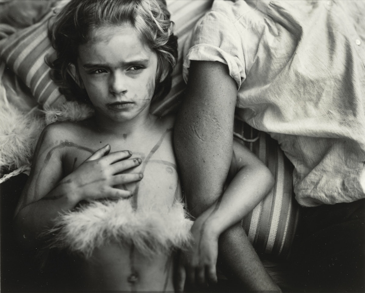 JESSIE BITES' by Sally Mann