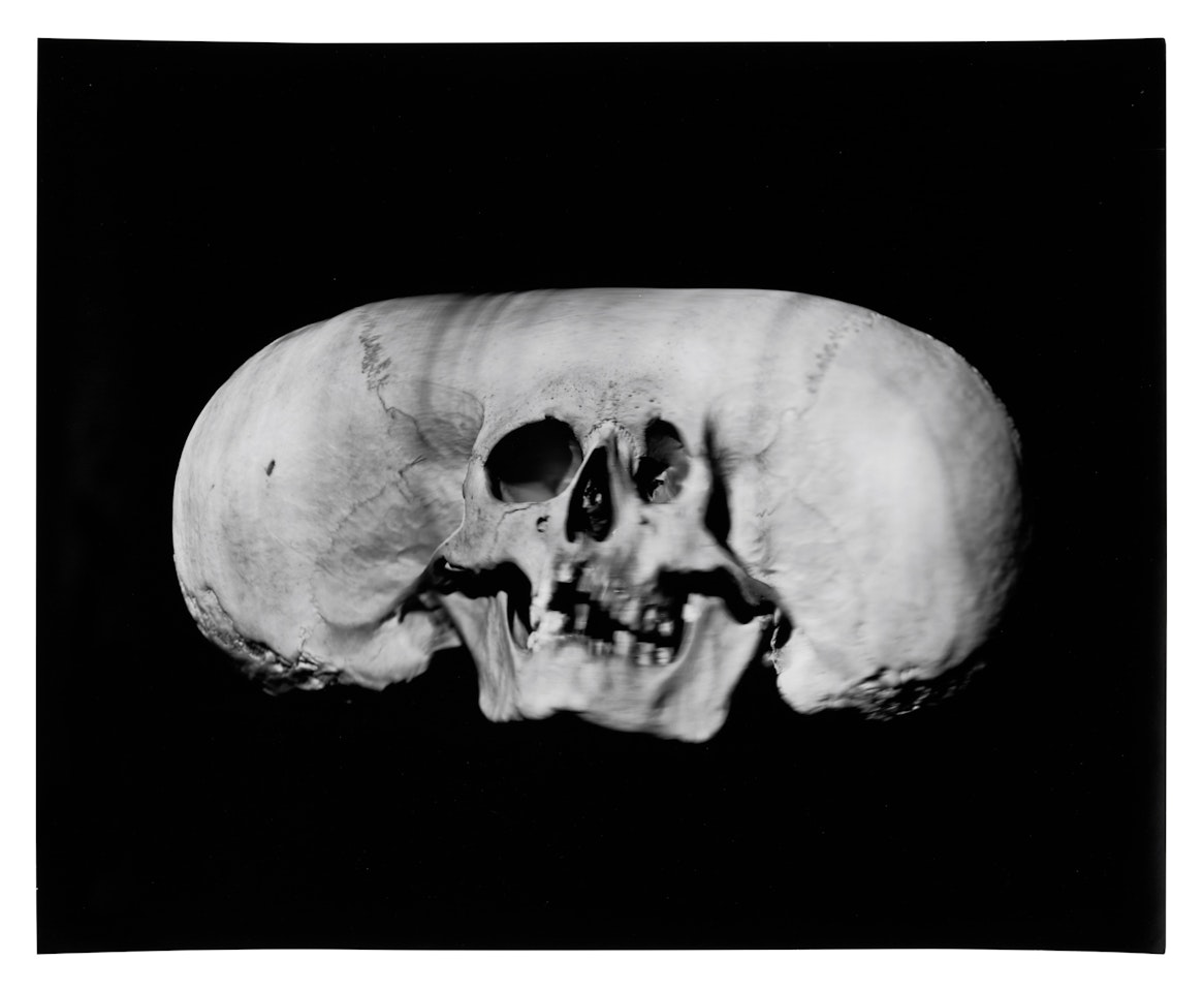 "Wide Skull, N.Y." by Irving Penn