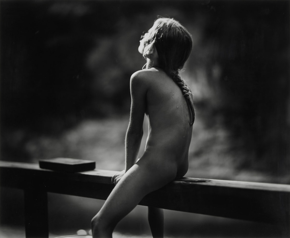 "Goosebumps" by Sally Mann