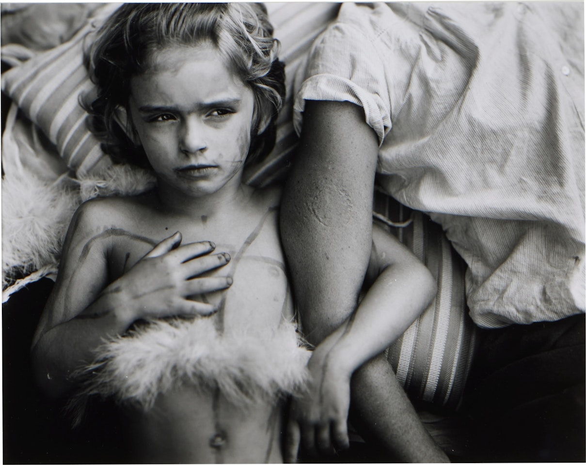 Jessie Bites by Sally Mann