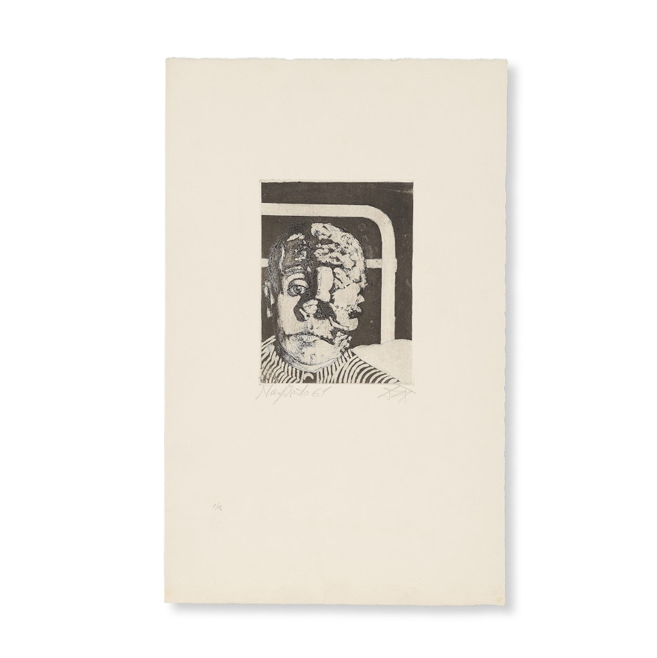 Transplantation; Issue de la suite "Der Krieg"; Etat IV by Otto Dix